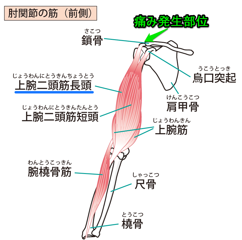 ボール を 投げる と 上腕 二 頭 筋 が 痛い